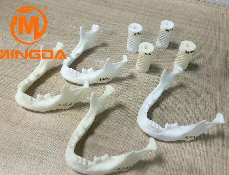 工业级3D打印机在牙科行业的应用(图1)